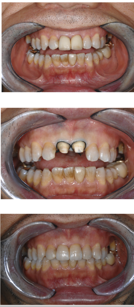 da Vinci Dental Studios fixed restorations